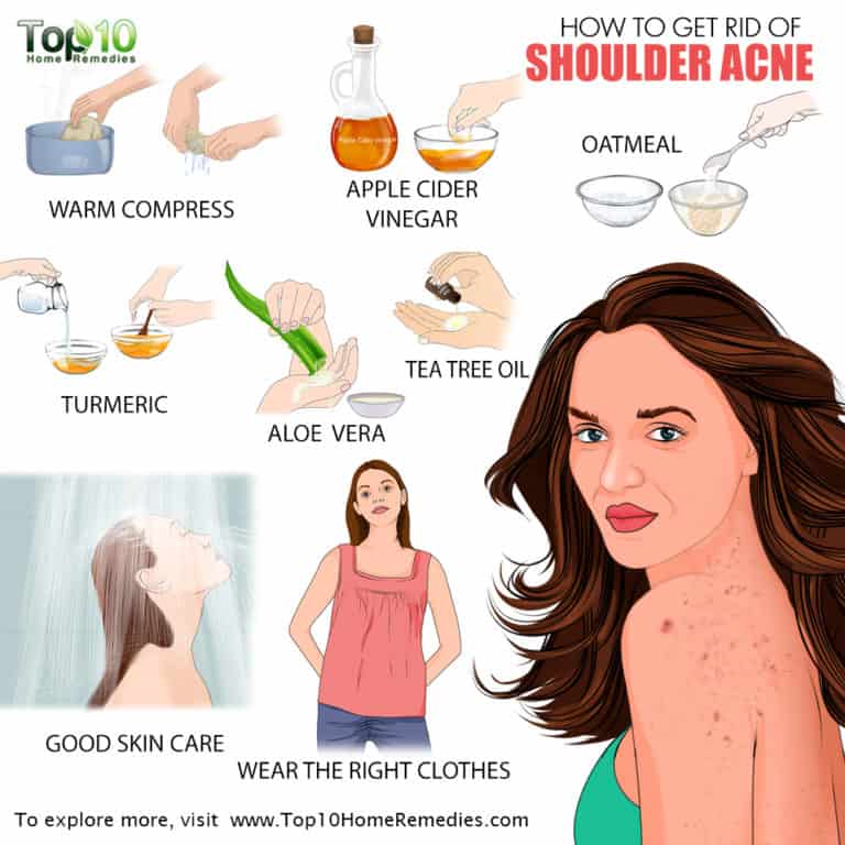 how to get rid of back pimples and shoulder pimples