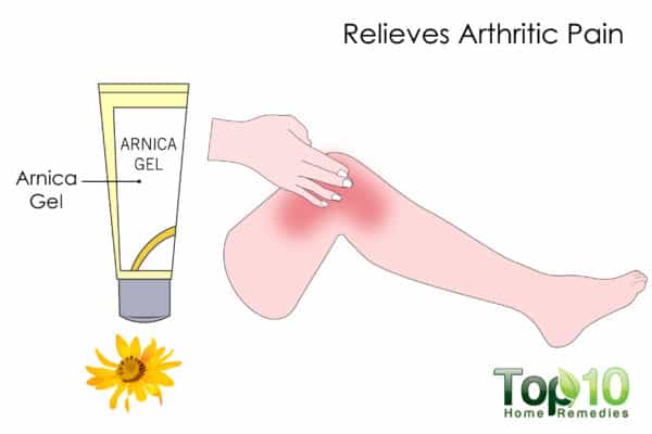 arnica relieves arthritis pain