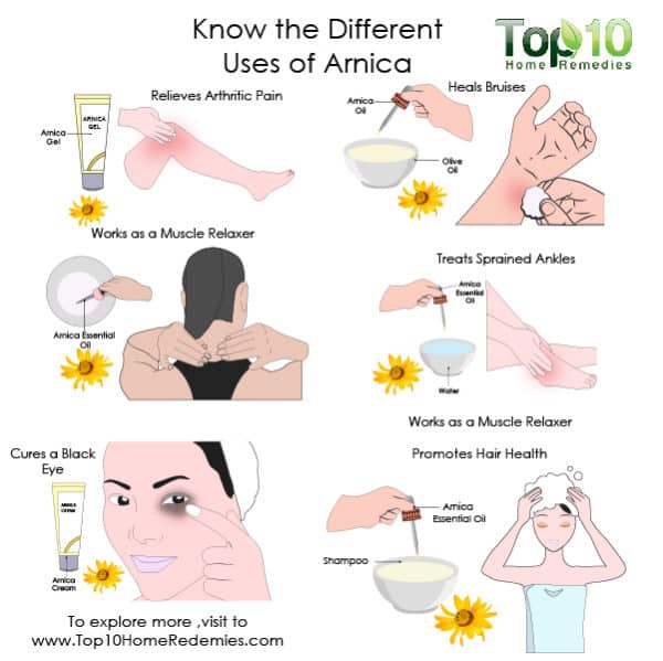 Know the Different Uses of Arnica Top 10 Home Remedies