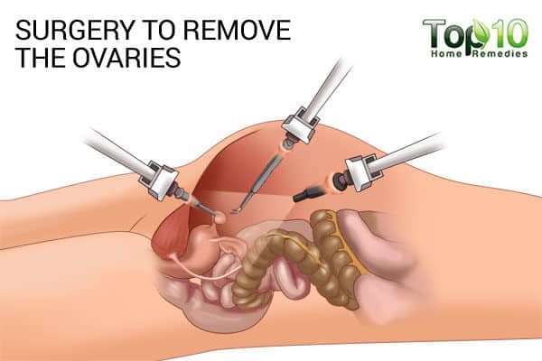 la chirurgie pour enlever les ovaires peut entraîner une ménopause précoce