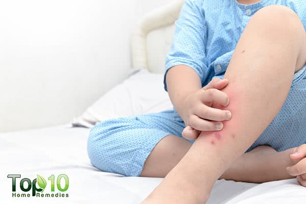 insect bites and rashes