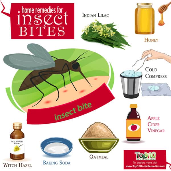 home remedies for insect bites