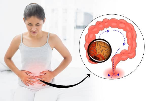 pinworm infection