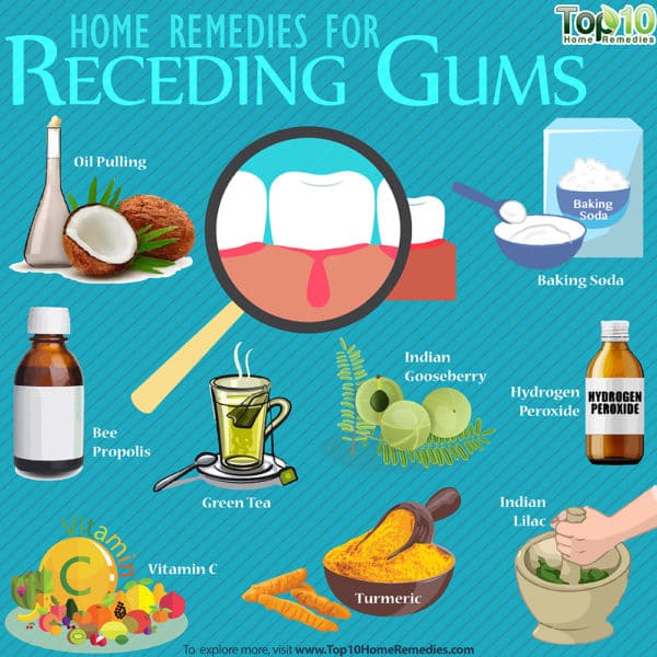home remedies for receding gums