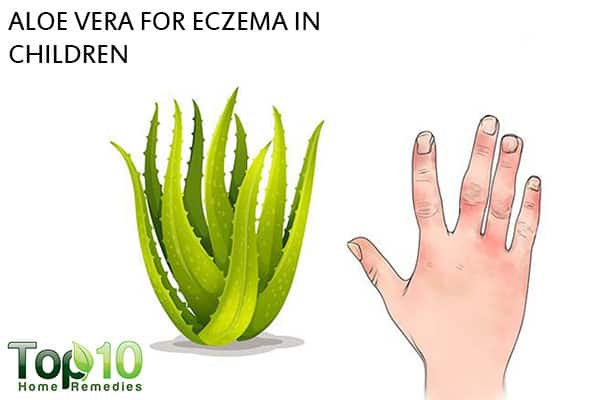 aloe vera to heal eczema in children