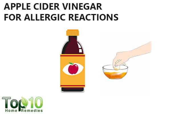 apple cider vinegar to treat allergic reactions