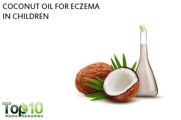 coconut oil for eczema in babies