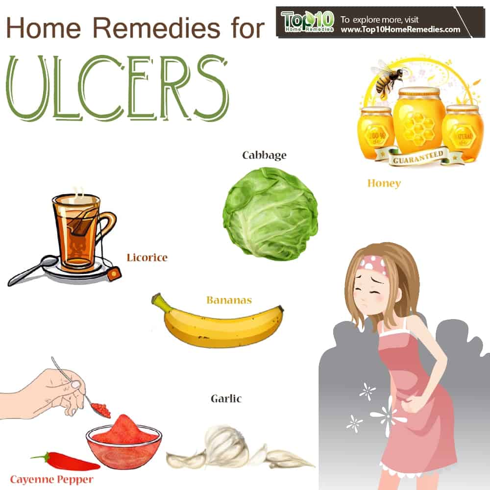 Home Remedies for Ulcers Top 10 Home Remedies