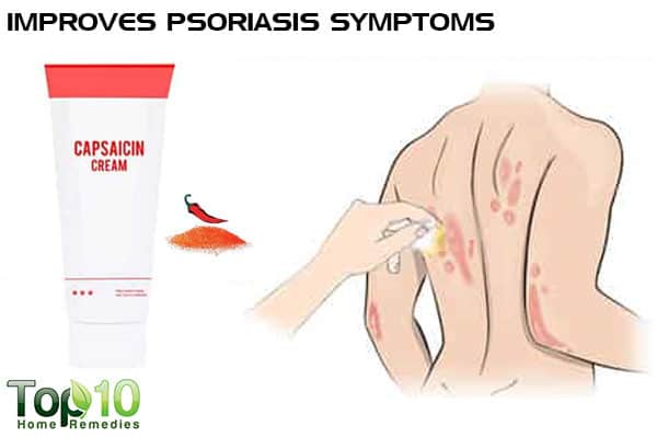 Capsaicin improves psoriasis