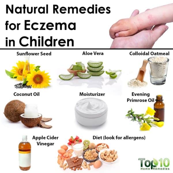 Natural Remedies For Eczema In Children Top 10 Home Remedies