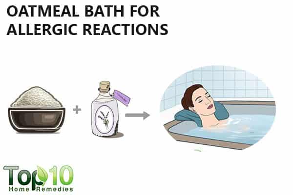 oatmeal to manage allergic reaction