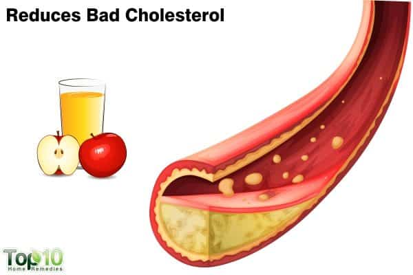 apple cider vinegar reduces bad cholesterol