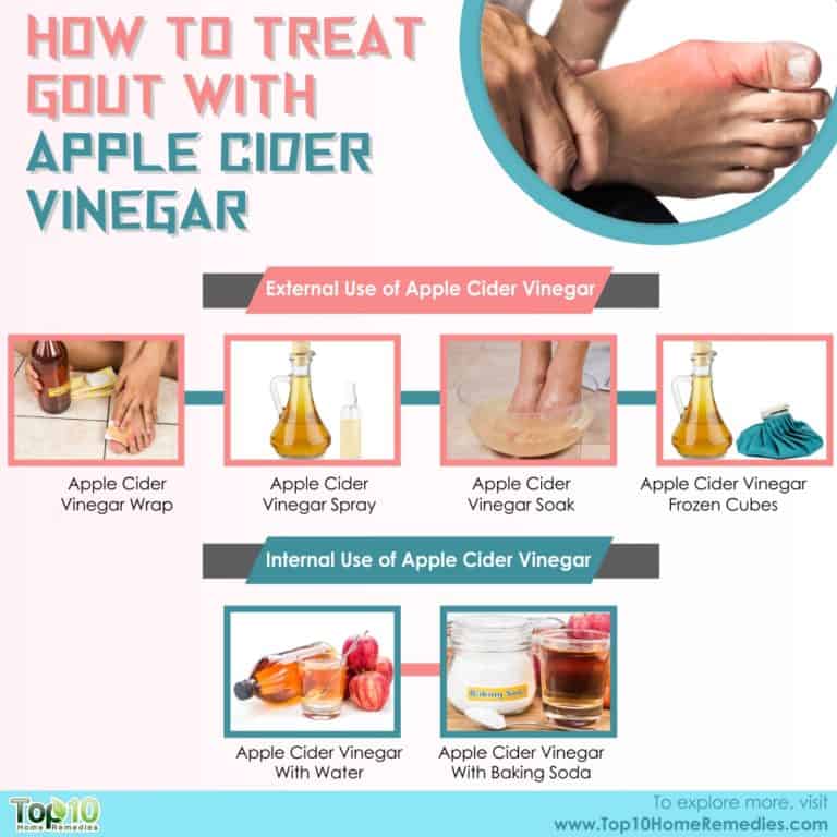 Can You Treat Gout with Apple Cider Vinegar? Top 10 Home Remedies