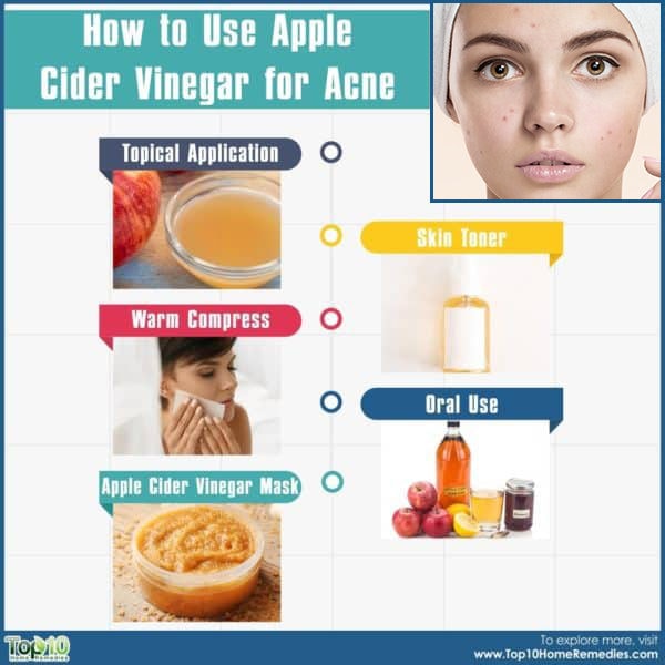 Apple Cider Vinegar for Acne