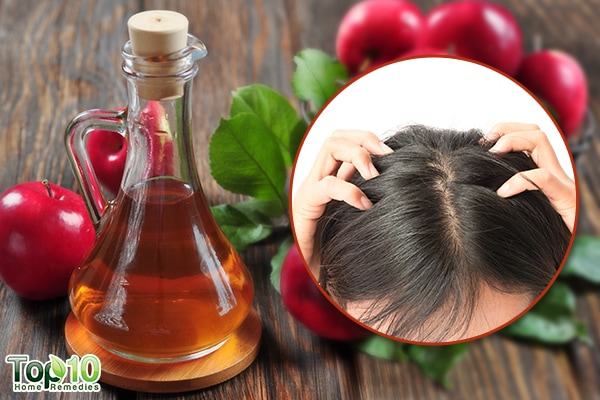 The Use Of Apple Cider Vinegar To Kill Lice Top 10 Home Remedies
